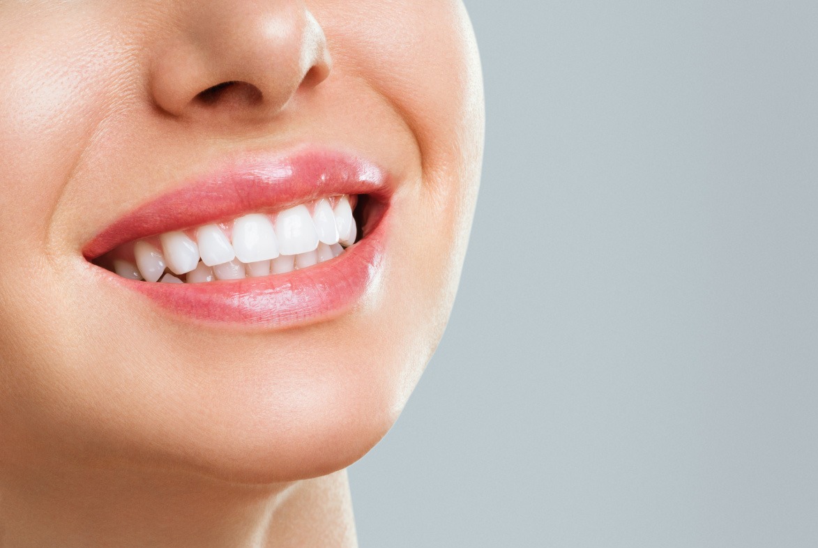 لبخند - روش خانگی سفید کردن دندان