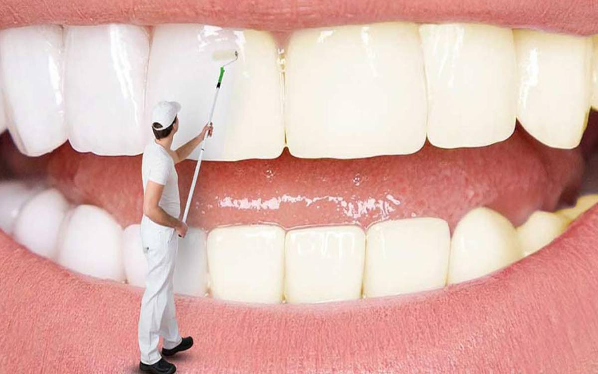 سفید کردن - سفيد كردن دندان با جوش شيرين