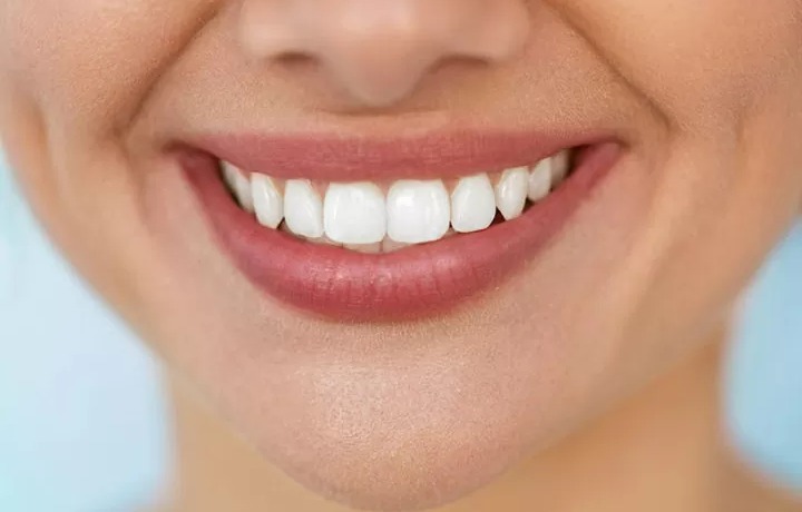 دندان سفید - سفيد كردن دندان با جوش شيرين