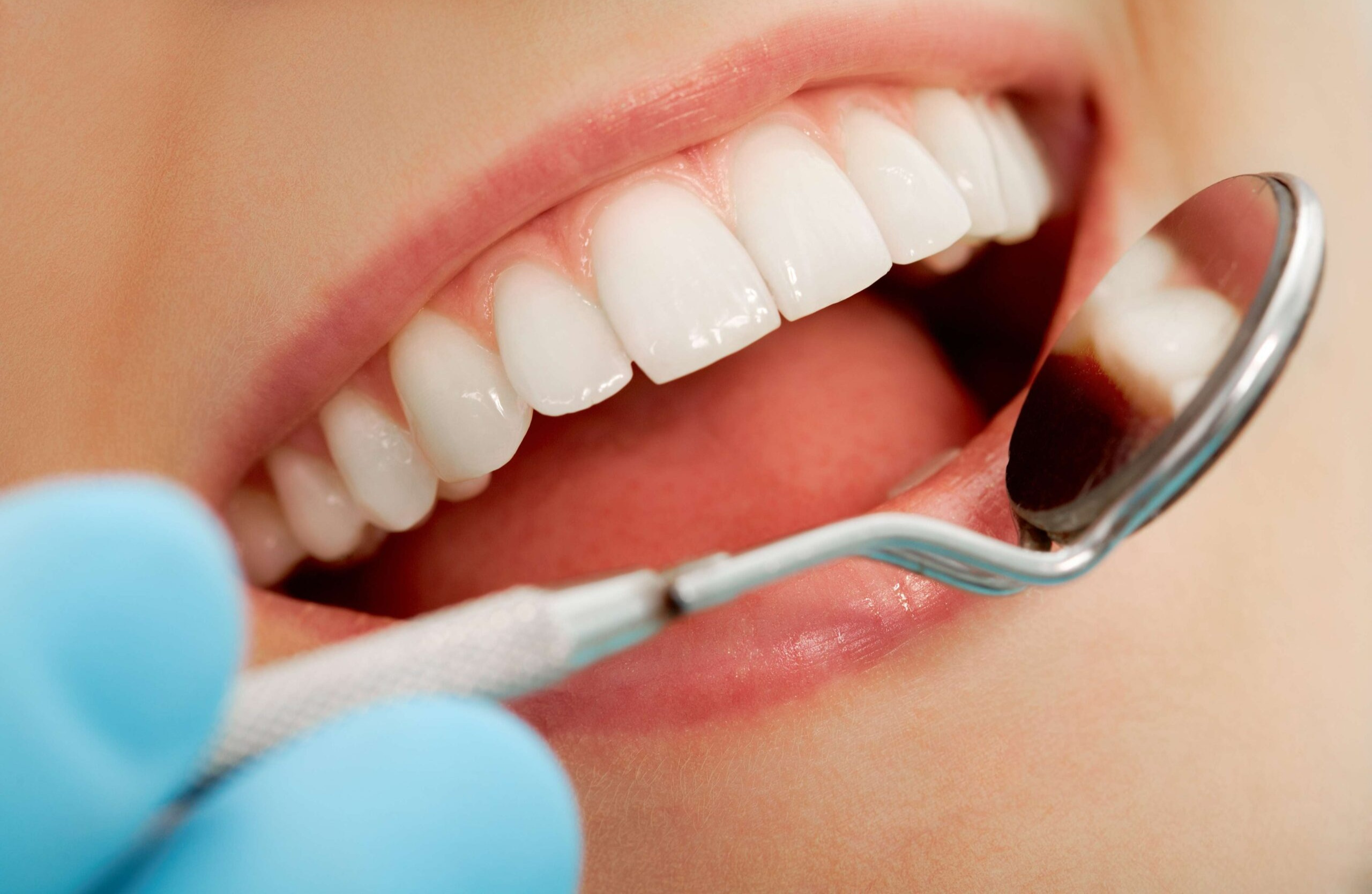 دندانپزشکی - از بین بردن بوی بد دهان