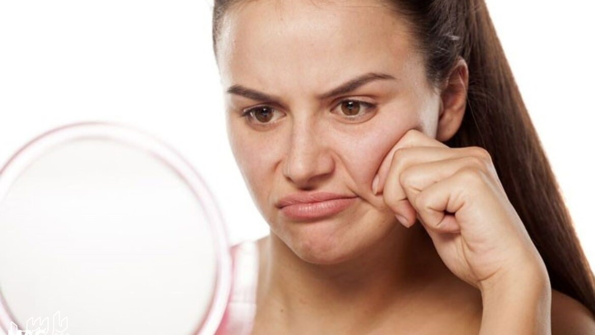 چروکیده شدن پوست - جلوگیری از لاغری صورت