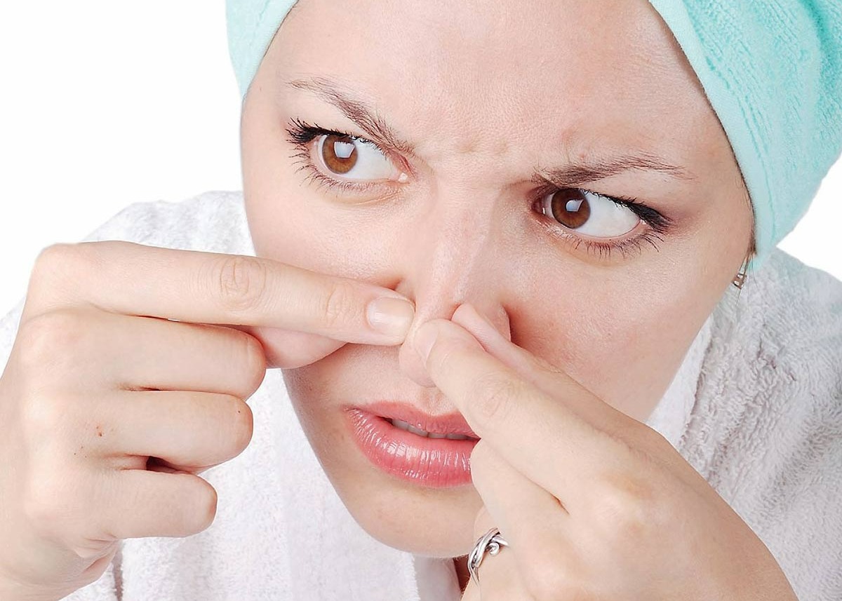 از بین بردن جوش سر سیاه - جوش سیاه