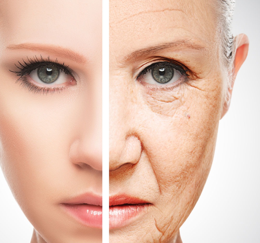 تغییرات پوست - سفت شدن پوست صورت