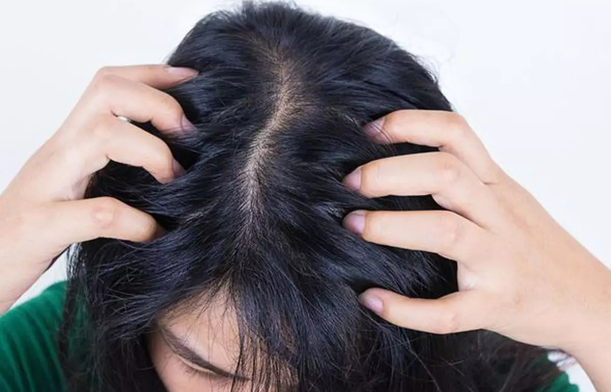 موهای پر شوره - درمان خشکی مو