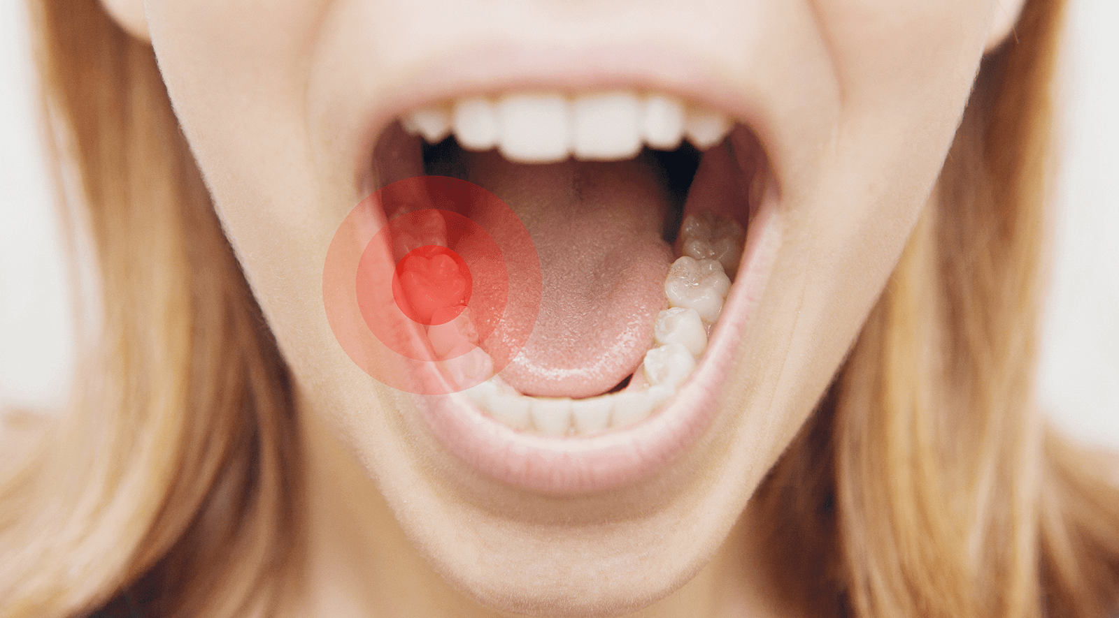 درد دندان عصب کشی شده