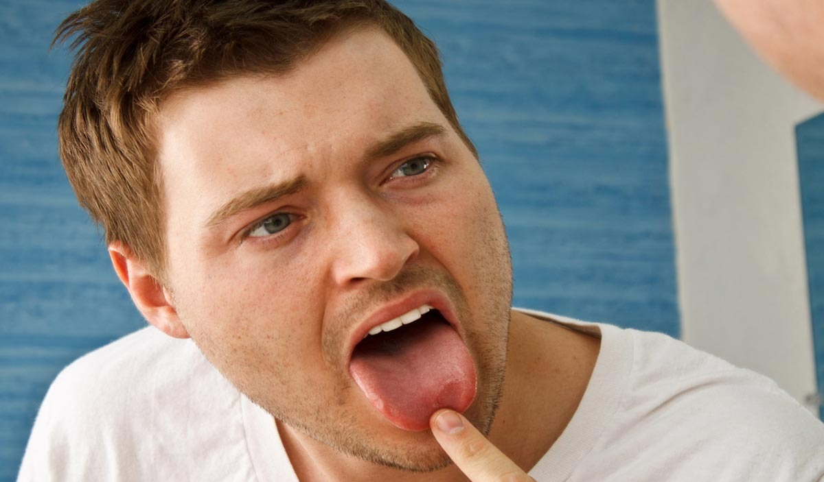 تلخی دهان - علت خشکی دهان