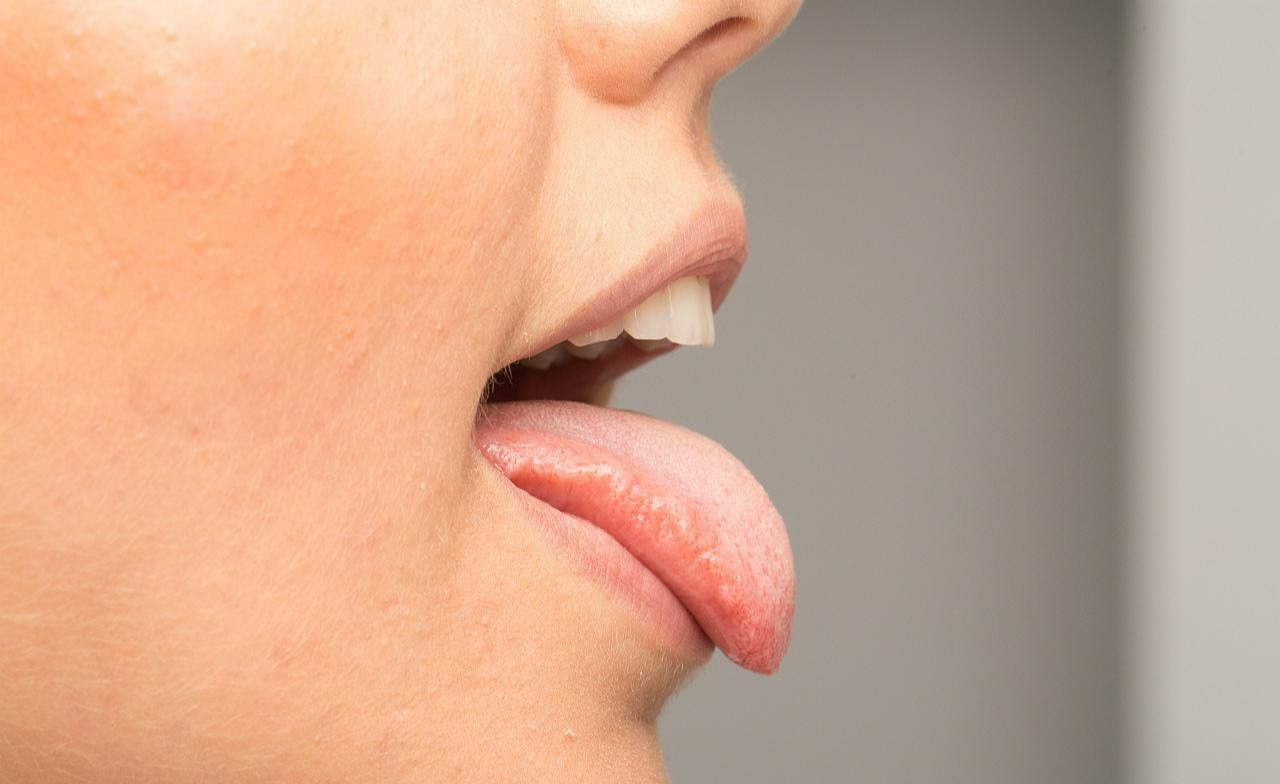 زبان در آوردن - علت خشکی دهان