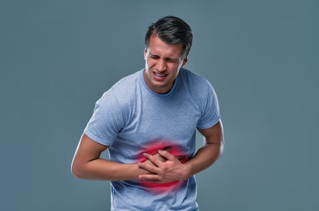 سندروم روده تحریک پذیر