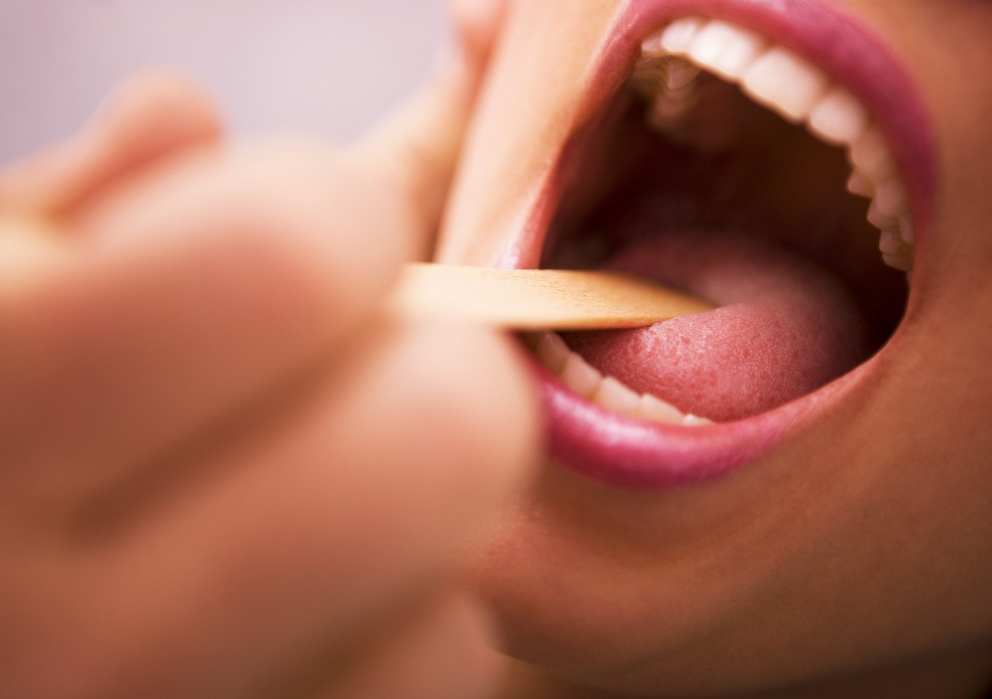 درمان آفت دهان - علت جوش نوک زبان