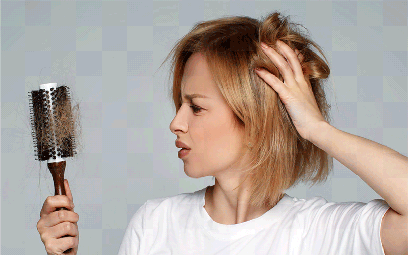 علت ریزش مو