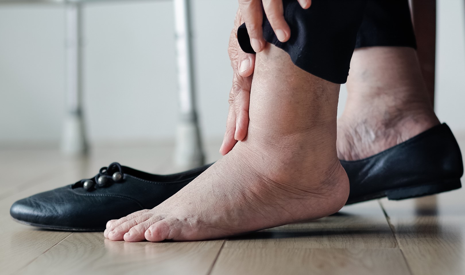 درمان ورم پا در مسافرت