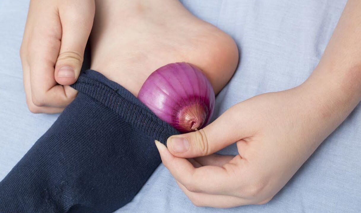 درمان ورم پا پیاز