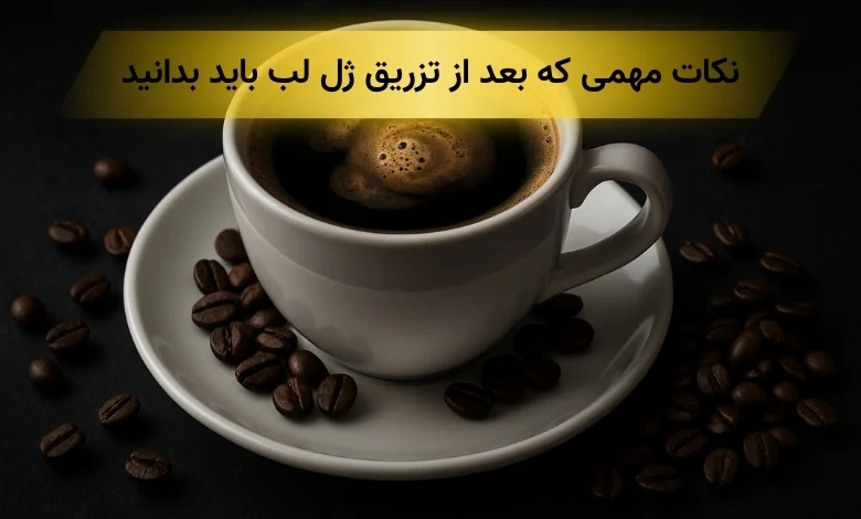 خوردن قهوه بعد از تزریق ژل لب