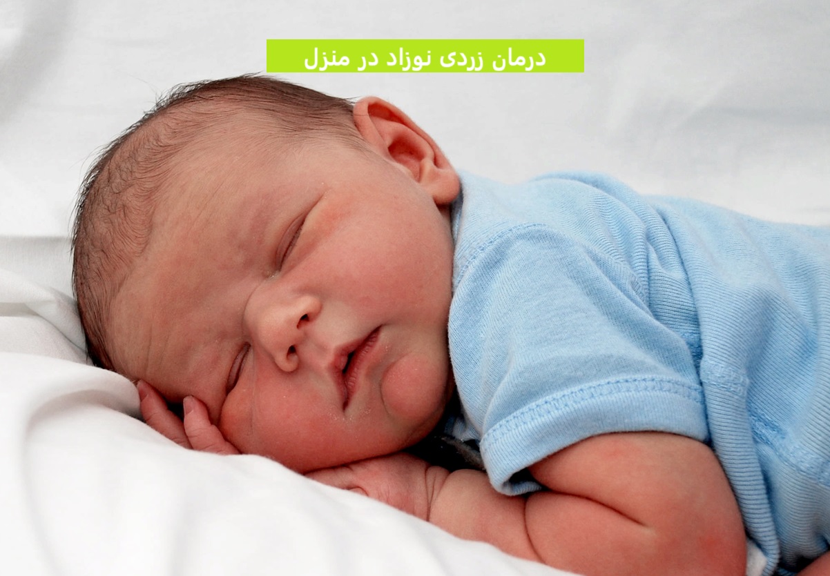 درمان زردی نوزاد در منزل