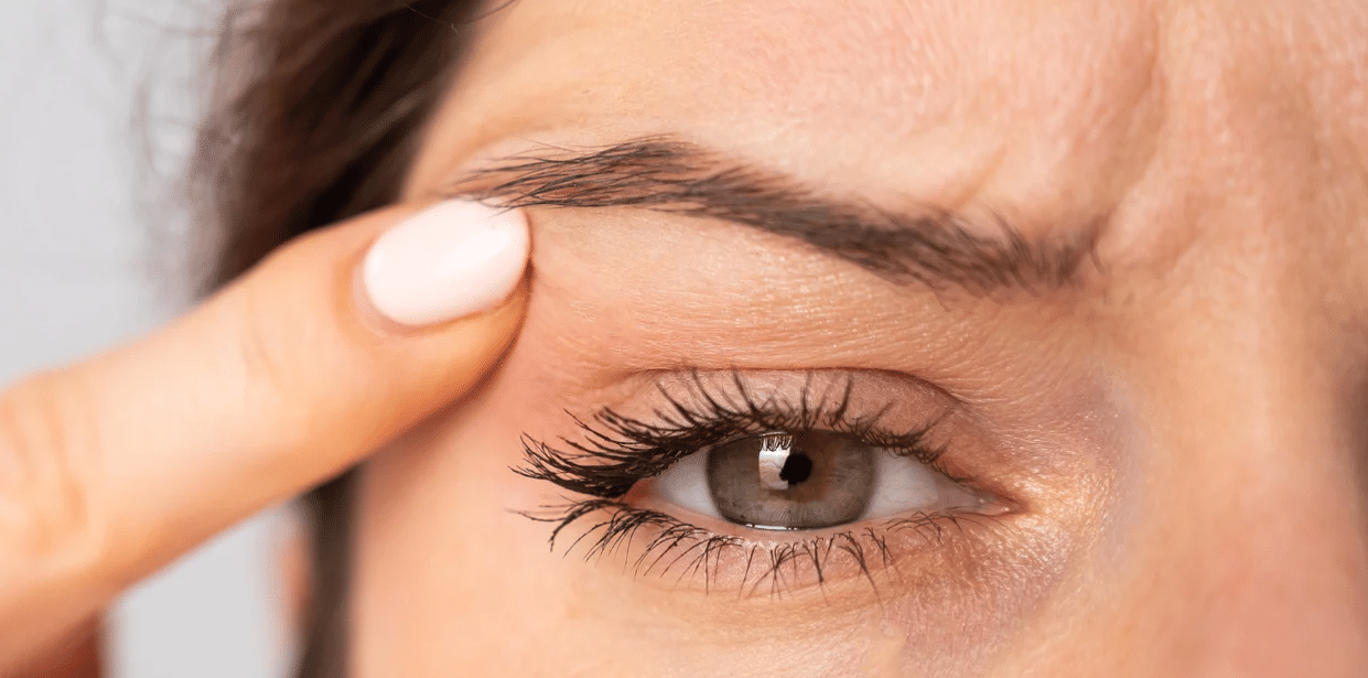 لیفت پلک - رفع افتادگی پلک در خانه