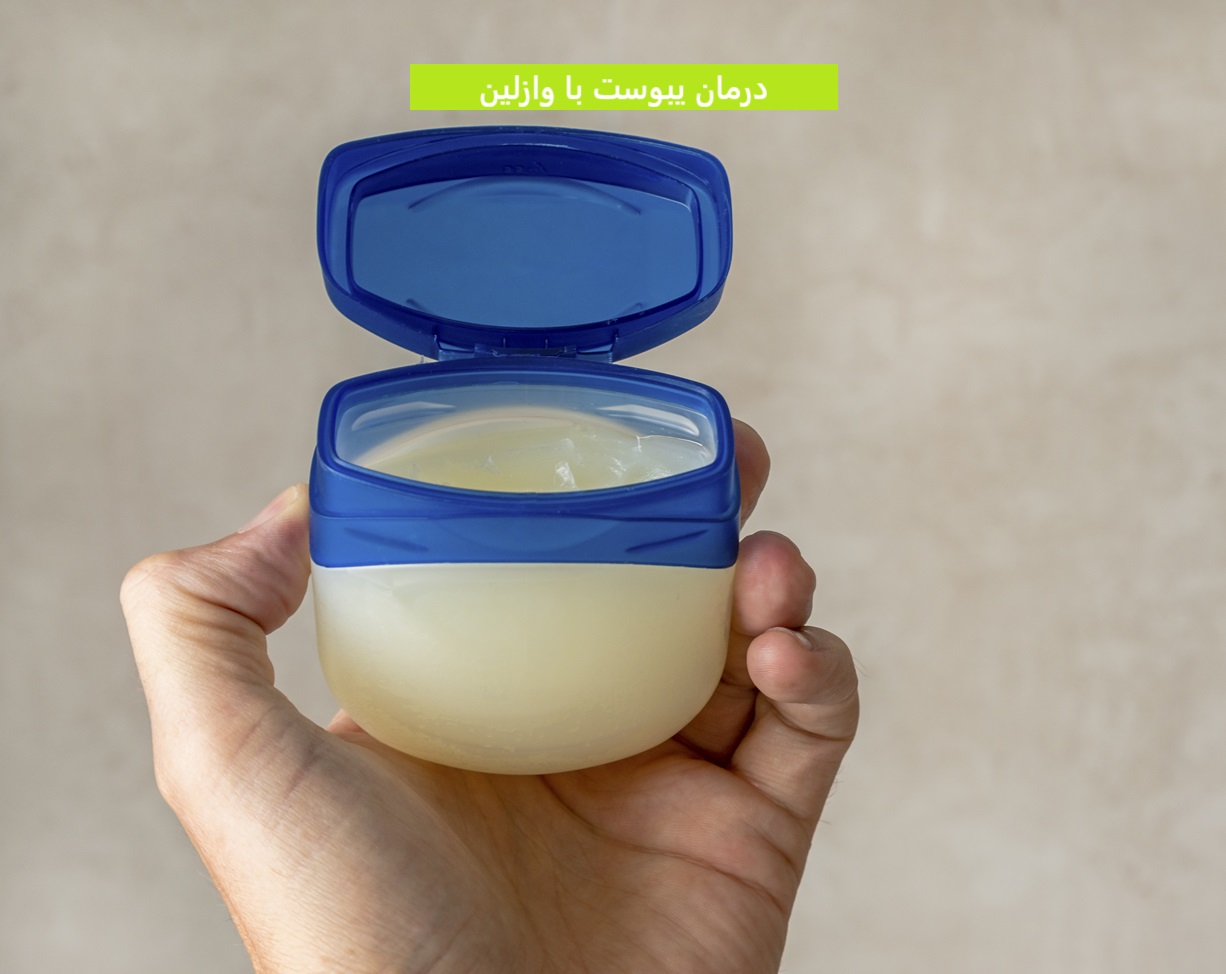درمان یبوست با وازلین